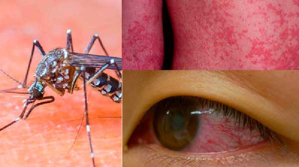 Phát hiện muỗi nhiễm virus Zika nhờ thiết bị hồng ngoại